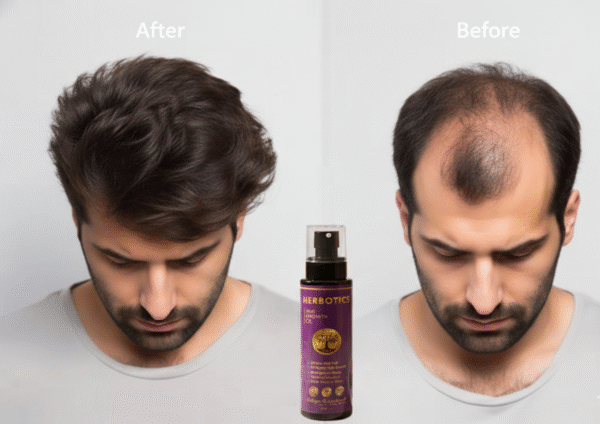 herbotics hair growth oil